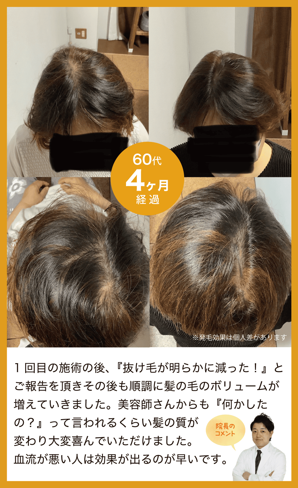 1回目の施術の後、『抜け毛が明らかに減った！』とご報告をいただきその後も順調に髪の毛のボリュームが増えていきました。美容師さんからも『何かしたの？』って言われるくらい髪の質が変わり、大変喜んでいただけました。血流が悪い人は効果が出るのが早いです。