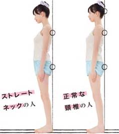 福岡 腰痛 筋筋膜性腰痛症の原因 改善率93 5 を誇る肩こり 腰痛 肩こり 股関節痛専門整体院 慶 けい 福岡市中央区薬院