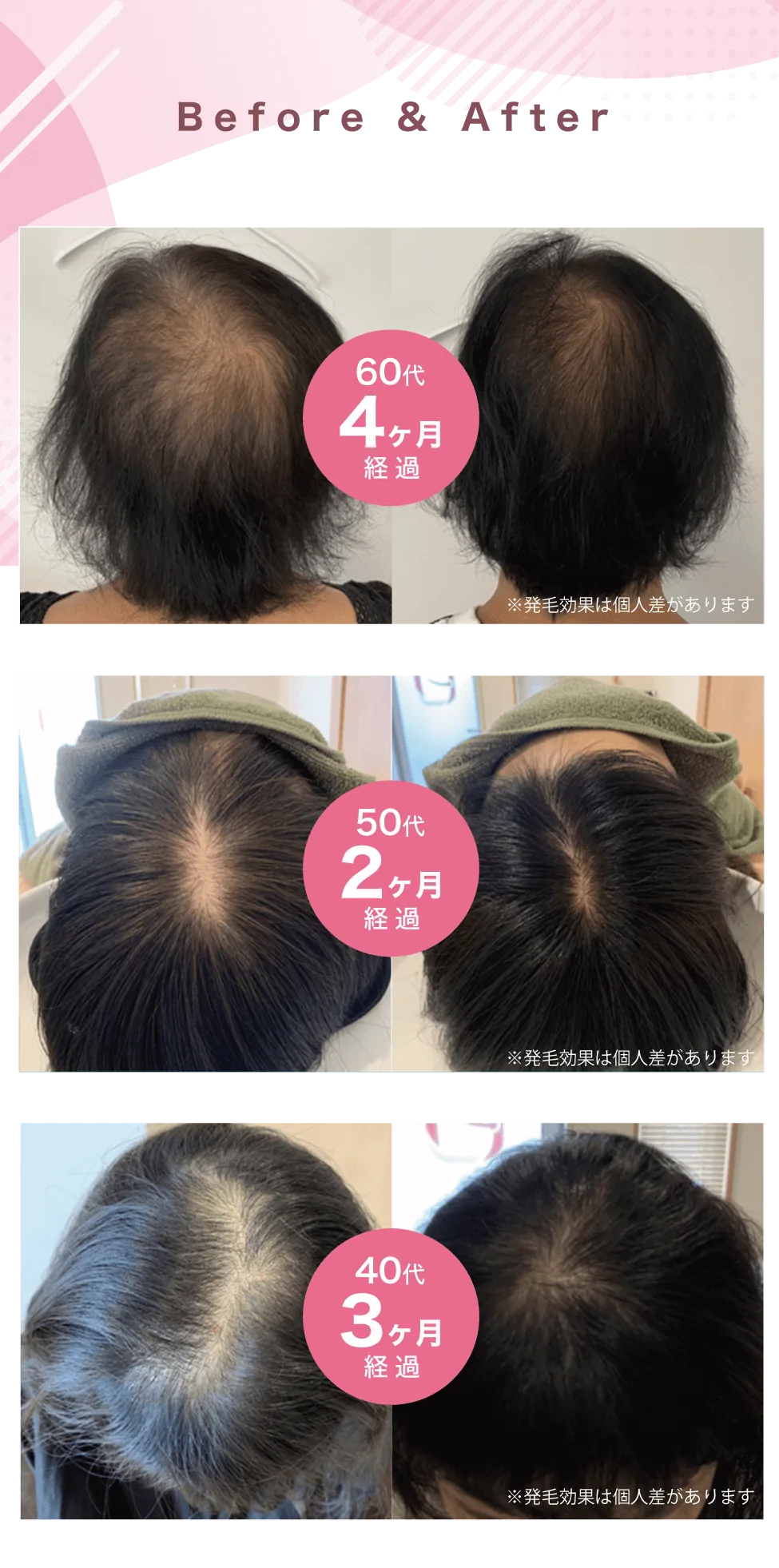 来院された方の施術前後の頭頂部の写真（60代・4か月、50代・2か月、40代・3か月経過）